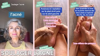 Soulager lacné  Tutoriel de réflexologie © Véronique Lecerf [upl. by Vassaux]