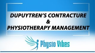 DUPUYTRENS CONTRACTURE amp PHYSIOTHERAPY MANAGEMENT [upl. by Ahsaeit]