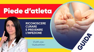 Piede d’atleta come riconoscere curare e prevenire l’infezione [upl. by Eejan]