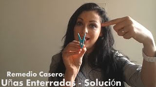 Uñas Enterradas  Solución  Psicóloga Lizeth Solorio [upl. by Nalliuq628]