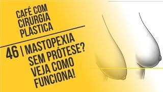 46 Mastopexia sem Prótese Veja como Funciona  Café com Cirurgia Plástica [upl. by Aliekahs969]