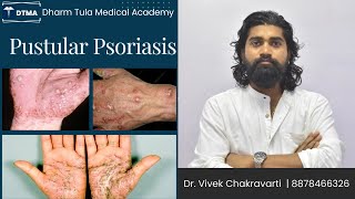 Pustular psoriasis  Psoriasis  Skin Disease  Skin psoriasis psoriasiscure psoriasissolution [upl. by Iadrahc]