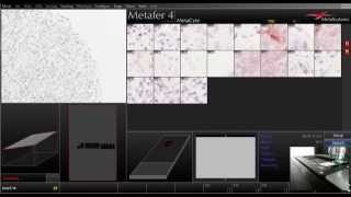 Metafer Tissue Microarray Scanning TMA [upl. by Elysha437]