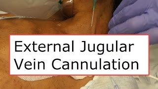 External Jugular Vein Cannulation [upl. by Adnorahs]