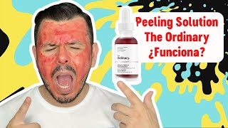 A prueba THE ORDINARY peeling solution ¿Funciona [upl. by Nowad169]