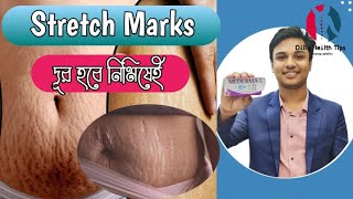 Pregnancy এর ফাটা দাগ দূর হবে নিমিষেই। Mederma Stretch Mark Therapy 100 কার্যকারী। [upl. by Cicenia998]