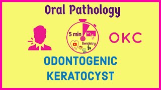 ODONTOGENIC KERATOCYST  OKC  ORAL PATHOLOGY  Exam notes  5mD [upl. by Larentia621]