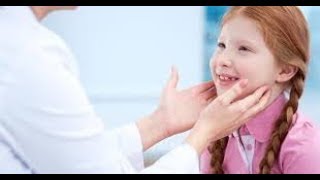 cervical lymphadenopathy in children [upl. by Oinotnaesoj]