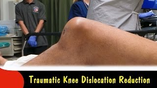 Traumatic Knee Dislocation ReductionQuick Version [upl. by Hulton]