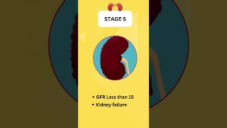 End Stage Renal Disease Stages [upl. by Geer372]