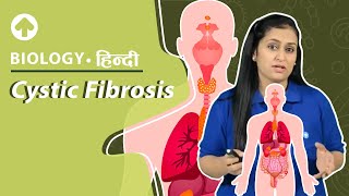 Cystic Fibrosis  Biology [upl. by Ardell720]