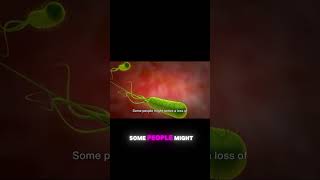 Symptoms of H Pylori Infection What to Watch For [upl. by Lipkin486]