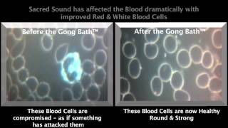 Gong Bath  Blood Testing  Before amp After Part 1 of 2 [upl. by Amak]