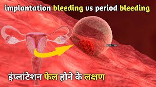 implantation symptoms  implantation bleeding vs period  implantation symptom  Ovulation [upl. by Ferris163]