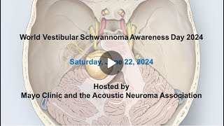 Electrical stapedius reflex testing during vestibular schwannoma resection and cochlear implantation [upl. by Cirdla]