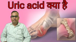 uric acid kya hai । क्यों होता है । iske side effect kya dekhne ko milte Hain [upl. by Arriet]