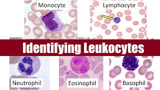 Identifying Leukocytes [upl. by Irol]