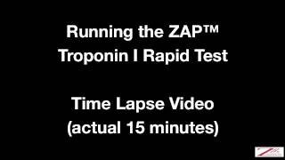 ZBx Cardiac Troponin I Rapid Test [upl. by Htnicayh]