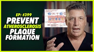 Ep399 PREVENT ATHEROSCLEROSIS PLAQUE FORMATION [upl. by Plato433]