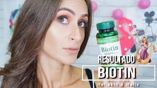 Resultado da Biotin 10000mg Biotina [upl. by Dorey]