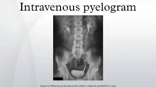 Intravenous pyelogram [upl. by Idnal]