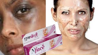 Nface skin cream  nface skin cream kaise use kare  nface skin cream side effects nface skin cream [upl. by Nolram]