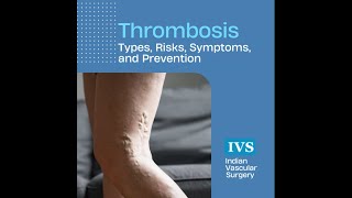 Thrombosis  Types Risks Symptoms and Prevention [upl. by Eseela]