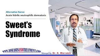 Sweet’s Syndrome  Causes Diagnosis Symptoms Treatment Prognosis [upl. by Nelia552]