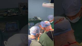 Hepatectomy I Advanced GI SURGERY I Liver Team I Surat I India [upl. by Magna328]