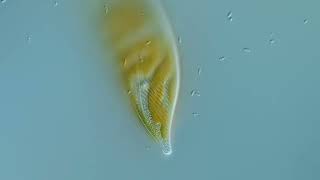 2 brackish Diatoms [upl. by Nnaaras]