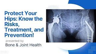 quotUnderstanding Hip Fractures Causes Symptoms and Treatment Options for a Speedy Recoveryquot [upl. by Edya]