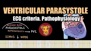 VENTRICULAR PARASYSTOLE ECG criteria Pathophysiology [upl. by Bethina]