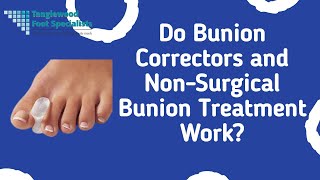 Do Bunion Correctors and NonSurgical Bunion Treatment Work [upl. by Volnay]