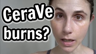 Why CeraVe products burn and sting Dr Dray [upl. by Notsa]