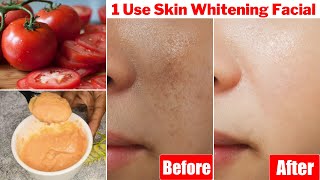 1 Time👆Skin Whitening Tomato Facial1 बार में निखर जाएगी रंगत दाग धब्बे होंगे साफ़ चमक उठेगा चेहरा [upl. by Ahsirk]