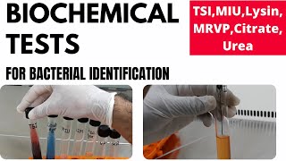 Biochemical Tests for Bacterial Identification Part1TSI MIU MRVP Lysin Urea Citrate [upl. by Ttevi825]