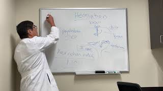 Brain herniation syndromes [upl. by Reiss]