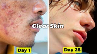 How to get clear skin in 28 days  Glowing skin [upl. by Alodie]