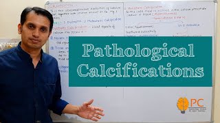 Pathologic Calcification Dystrophic and Metastatic Calcification  Calcification Pathophysiology [upl. by Adlev913]