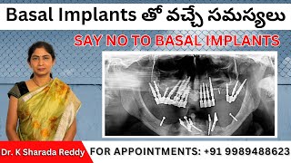 Basal Implants తో వచ్చే సమస్యలు  SAY NO TO BASAL IMPLANTS [upl. by Ymmat]