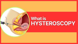 What is Hysteroscopy By Dr Mudita Jain [upl. by Nosecyrb973]