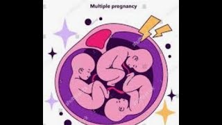 Multiple Miracles Ultrasound Guidance for HighRisk Pregnancies by Dr Robinson Alice [upl. by Edvard]