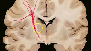 Sistematización de la médula espinal via corticonuclear y extra piramidal [upl. by Eyllib]