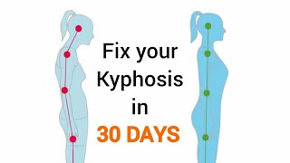 Fix your Kyphosis and hunched back in 30 days  NO EQUIPMENT  fitmarym [upl. by Sirrep628]