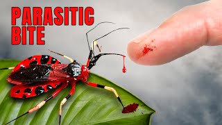 ASSASSIN BUG puts me in the Hospital [upl. by Noach768]