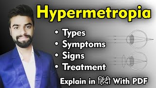 Hypermetropia amp Astigmatism Notes in PDF [upl. by Eremehc823]