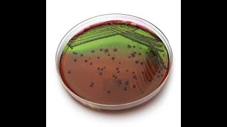 Contagem de coliformes totais termotolerantes e Escherichia coli [upl. by Aicetel502]