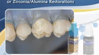 Discover BISCOs Intraoral Repair Kit [upl. by Dnomra]