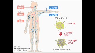 院内新聞803号youtube デュピルマブとリンパ腫 [upl. by Keynes]