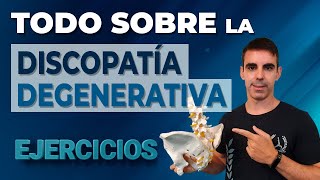 ★ DISCOPATÍA DEGENERATIVA TODO lo que necesitas saber ➕ 12 ejercicios para aliviar los síntomas [upl. by Packston985]